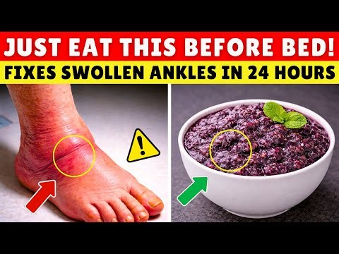 Swollen Ankles After 60? Just Eat THIS to Drains Swollen Ankles in 24 Hours