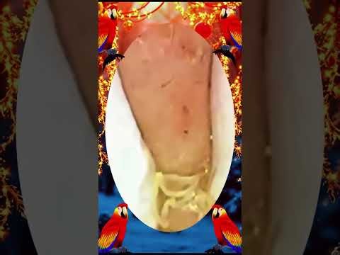 Satisfying Blackhead Removal | Acne Treatment, Pimple Pop & Deep Skin Clean-Up