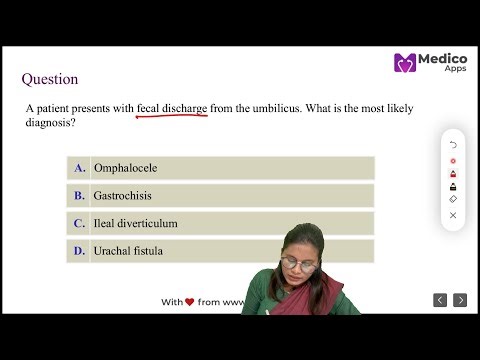 🔬Embryology High Yield:Meckel's Diverticulum vs Omphalocele vs Gastroschisis |NEET PG 🎯|Dr. Suvarna