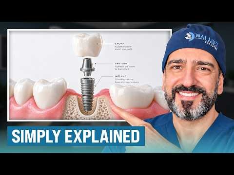Dental Expert Reveals 20 Years Of Implant Knowledge In 24 Minutes