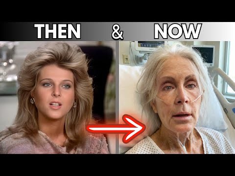 These Actors RUINED Their Faces | Then and Now Transformations