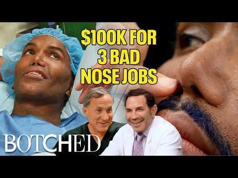Cut the Tip Off?! Norwood's Nose Jobs Are Hurting His Singing Career (Before & After) | Botched | E!