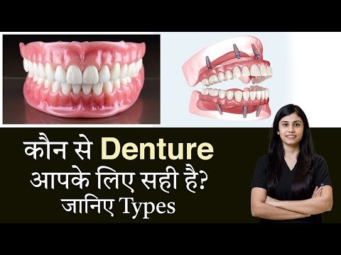 Kon Se Denture Aapke Liye Sahi Hain? | Types of Dentures Explained in Hindi | Indore India