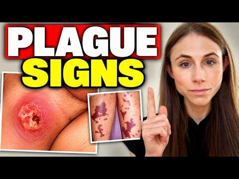 Plague Is Trending: What Does Plague Look Like on the Skin?