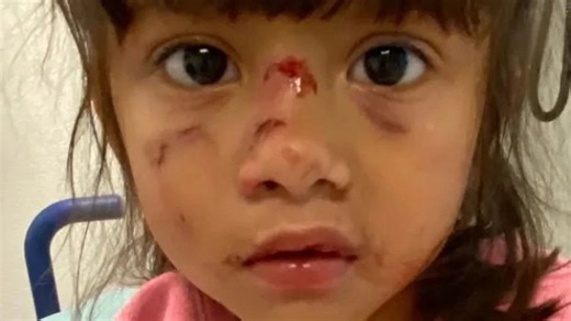"Horror Movie": Illegal Alien Attacks Mother, Eats 3-Year-Old's Face