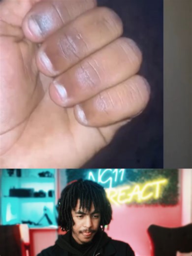 Ng11 React Addis Ababa TikTok Clips