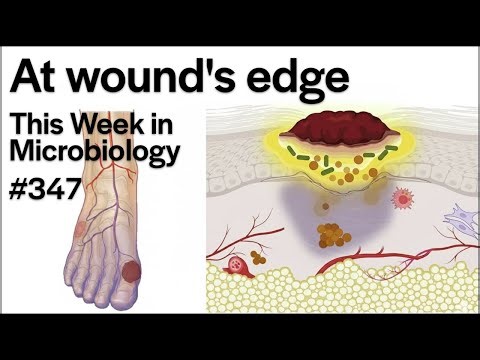 TWiM 347: At wound's edge