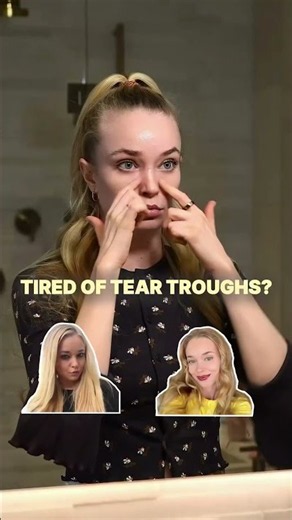 Tired of Tear Troughs? Try This #shorts