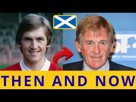 Scotland’s 1982 World Cup Heroes 🏆 Past vs Present