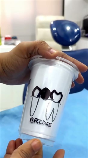 Best Options to Replace a Missing Tooth