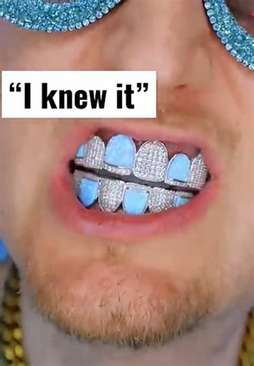 Diamond grillz diamond boy diamond tester diamond life diamond drip | Diamond