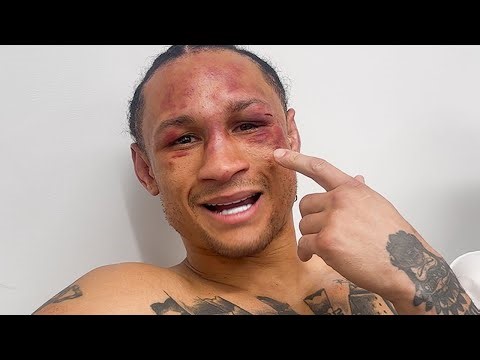 Regis Prograis RETIRES After LOSS to Conor Benn: “Perfect Way To End It!” — Says Haney Beats Him