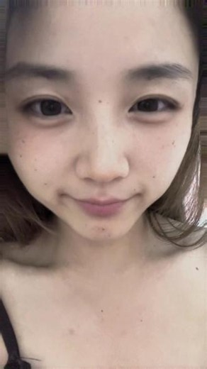 三十岁一脸痣了 #原生脸搭配odd太高级了