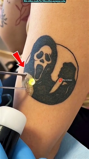 😱 How Does Laser Tattoo Removal Actually Work? The Science Revealed!