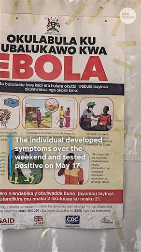 CDC confirms American Ebola case after Congo exposure