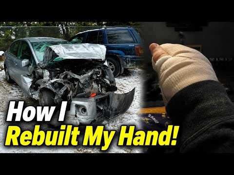 I Broke My Hand! Here's How I Got It Back