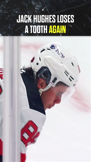 Déjà Tooth