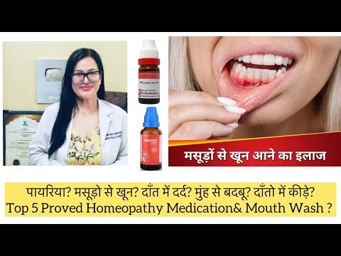 मसूड़ो से खून? मुंह से बदबू?Best 5 Homeopathic Medicine In Gum , Mouth Bleeding?Pyorrhoea,Bad Breath