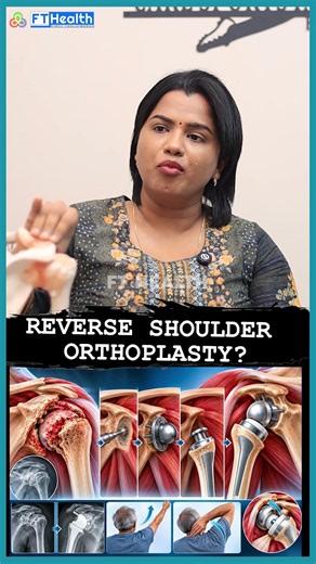 What Is Reverse Shoulder Arthroplasty? | Who Needs It & How Does It Work? | FT Health