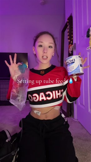 Setting up tube feeds for gastroparesis and Ehlers-Danlos