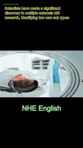 Scientists make major MS discovery in 'step toward' new treatment