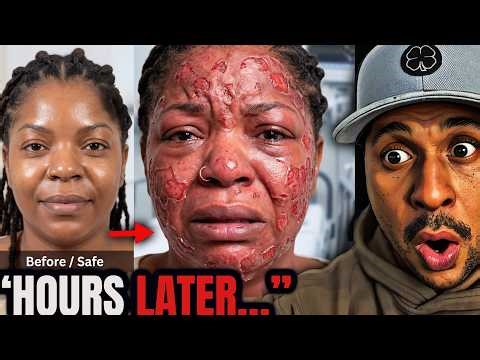 She Got This “Safe” Procedure… Hours Later It Turned BAD FAST 😳