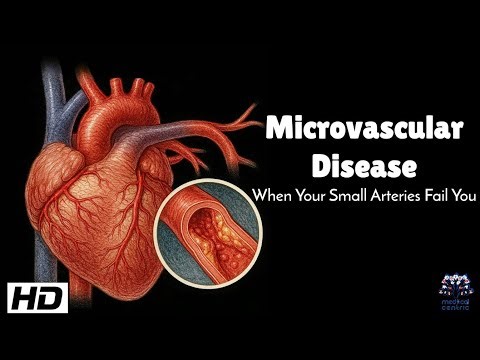 Microvascular Disease : When Your Small Arteries Fail and Big Problems Begin