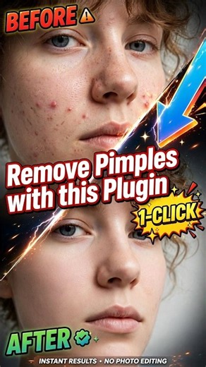 Remove Pimples with this Plugin #retouchingtutorial #blackheads #letestphotoshop