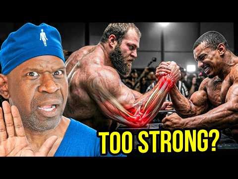 Would Andrey Smaev Break Arm Wrestling — Or Would Arm Wrestling Break Him? Surgeon Reacts