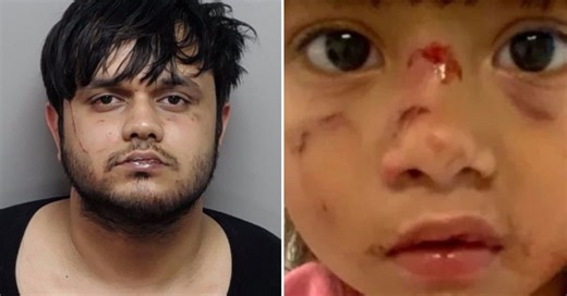 ‘Like a Scene Out of a Horror Movie’: Illegal Alien Arrested After Punching Mother in the Face and Savagely Biting and Trying to Eat Her Three-Year-Old Daughter’s Face in Unprovoked Texas Park Attack - Conservative News & Right Wing News | Gun Laws & Rights News Site