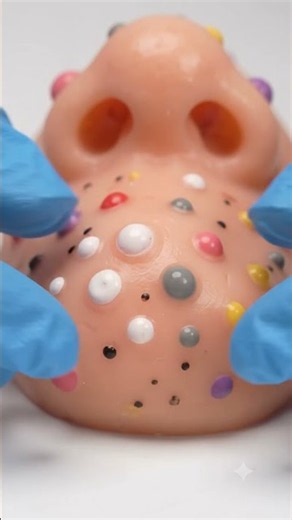 Rainbow Bump Nose | Satisfying Blackhead Popping ASMR #shorts