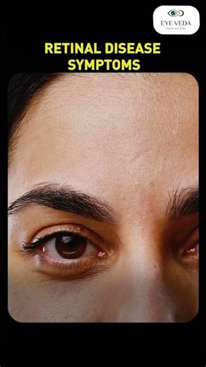 Seeing Floaters or Flashes? It Could Be a Retina Problem