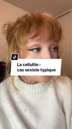 Understanding Cellulite: Causes and Treatment Options