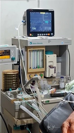 Laparoscopic Gallbladder Removal for Gallstones | Patient Guide #cholelithiasis #gallbladder