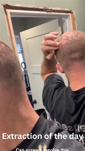Order new scalp