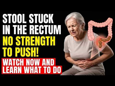 Stool Stuck in the Rectum! Is There a Solution? What Is It and What to Do? | Proctologist Explains