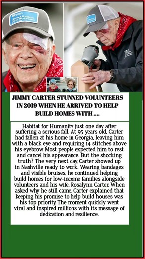 Jimmy Carter Showed Up to Build Houses One Day After Getting 14 Stitches 🫡
