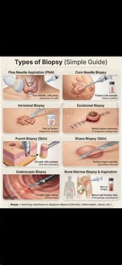 Everyone prays not to have a Biopsy, but at least, we need to have knowledge of it.#fyp #foryou