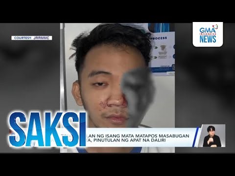 Lalaki, tinanggalan ng isang mata matapos masabugan ng paputok | Saksi