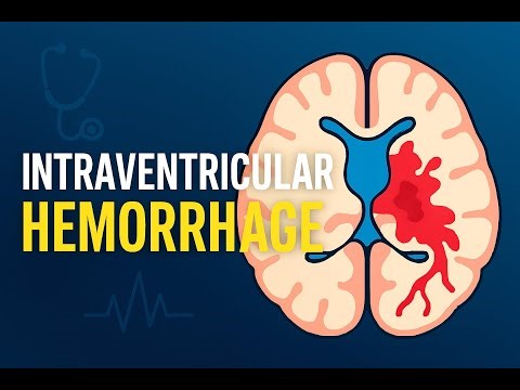 Neonatal Intraventricular Hemorrhage IVH Pathophysiology, Risk Factors, Cranial Ultrasound & Grading