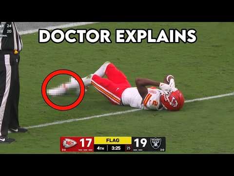 Tyquan Thornton Horrific Ankle Injury After Big Catch - Doctor Explains