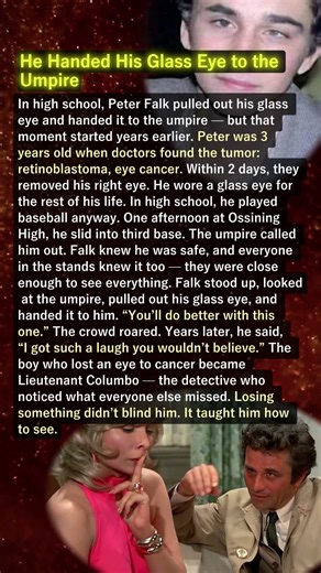 He Handed His Glass Eye to the Umpire👁️