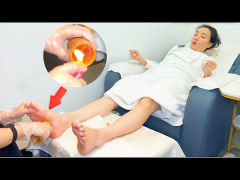 Fast & Intense Foot Massage + Cupping Therapy | Immersive ASMR for Sleep