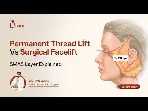 Permanent Thread Lift vs Surgical Facelift | SMAS Layer Explained | Dr Amit Gupta