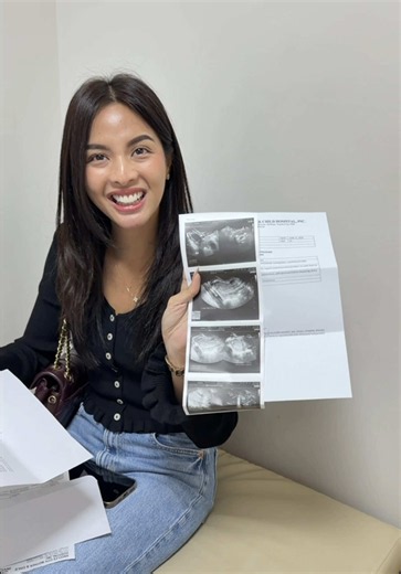 nagpa check up ako | ericka pineda