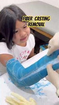 Fiber Casting Finally Removed after 2 months👌