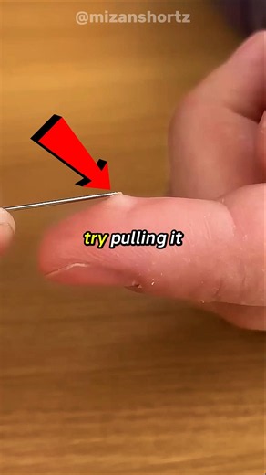 Secret Method To Remove A Splinter 😱