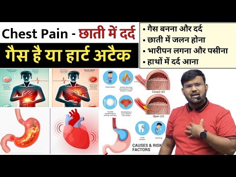 छाती में दर्द | Abdominal Pian | Bloating | Heart Attack | Acidity | Acid Reflux | Treatment | MBBS