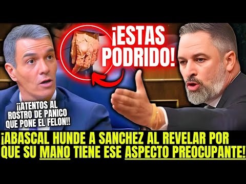 ¡ABASCAL SE BURLA DEL FÍSICO DE SÁNCHEZ! "REVELA LO DE SU MANO" ESTO ES LO QUE PASÓ EN EL CONGRESO