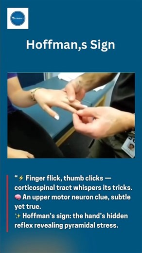 Hoffman’s Sign || Dr Medical Clinical Cases || Diagnosis || Education || Neurology ||